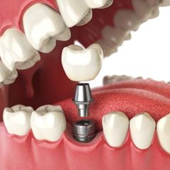 clinica dental bogota